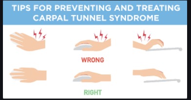 carpal tunnel syndrome, wrist pain, hand numbness, tingling hands, carpal tunnel relief, wrist brace, carpal tunnel symptoms, hand pain, nerve compression, carpal tunnel exercises, ergonomic support, carpal tunnel treatment, hand weakness, wrist surgery, repetitive strain injury, carpal tunnel prevention, hand therapy, workplace ergonomics, carpal tunnel doctor, Elite Wellness