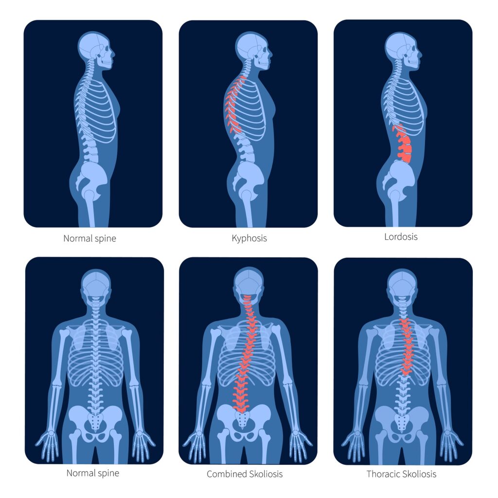elitewellness, lower, back pain, backpain